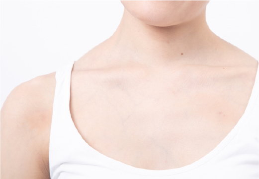 Beauty Skin Clinic 首（広頚筋）