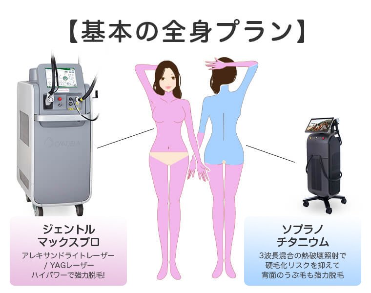 ジェントルマックスプロ×ソプラノ 全身+うなじ医療脱毛 基本の全身プラン ジェントルマックスプロとソプラノチタニウムを使います