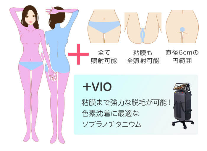 ジェントルマックスプロ×ソプラノ 全身+うなじ+VIO 医療脱毛の照射範囲