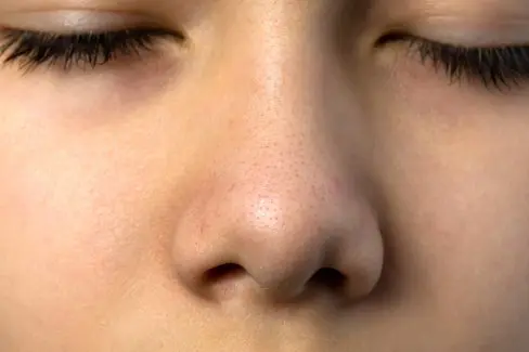 BEAUTY SKIN CLINIC（ビューティースキンクリニック） 革新的シミ治療ルメッカ