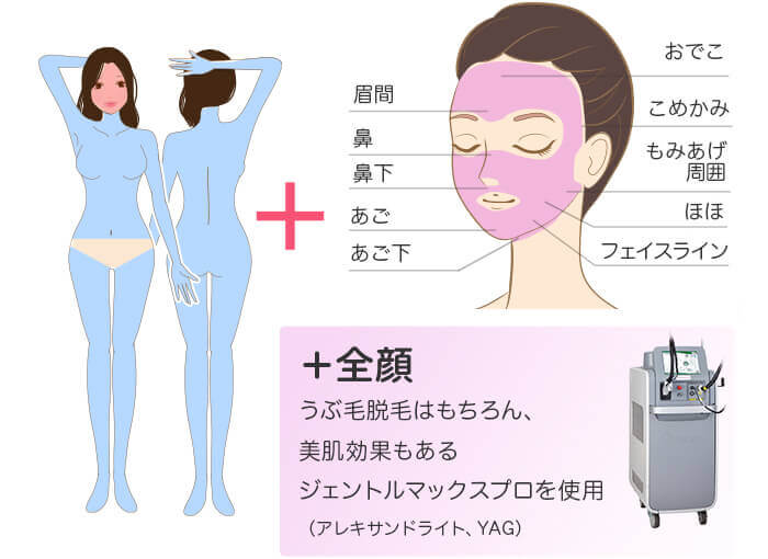 メディオスター・ソプラノ選べる 全身+うなじ+顔 医療脱毛の照射範囲