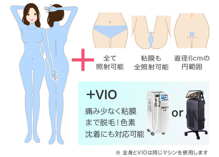 メディオスター・ソプラノ選べる 全身+うなじ+VIO 医療脱毛の照射範囲