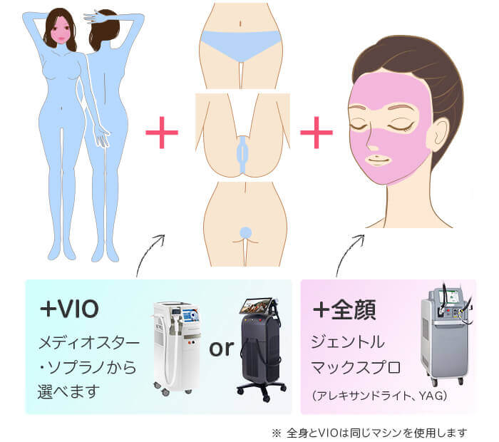 メディオスター・ソプラノ選べる 全身+うなじ+顔+VIO 医療脱毛の照射範囲