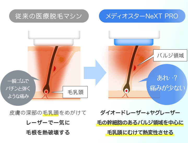 メディオスターNeXT PRO