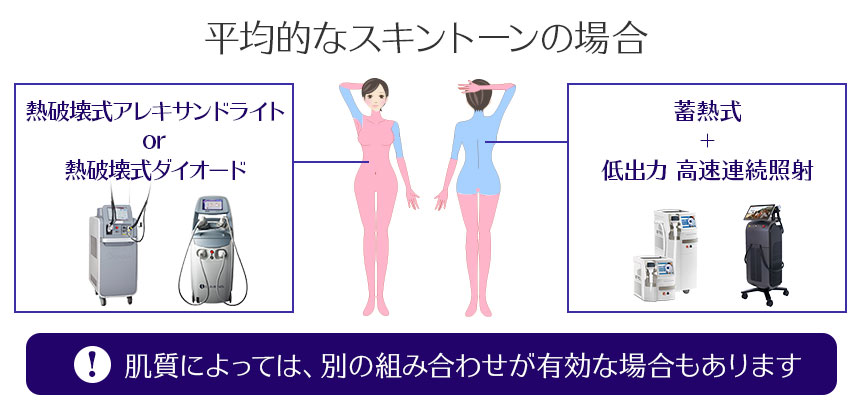 平均的なスキントーンの場合の医療脱毛レーザーの使い分け