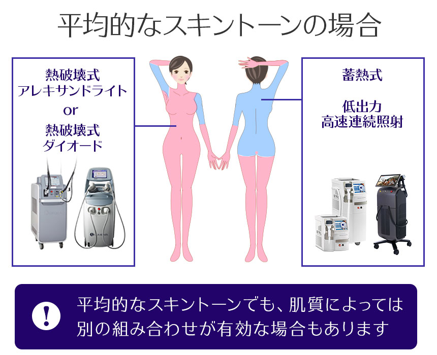 平均的なスキントーンの場合の医療脱毛レーザーの使い分け