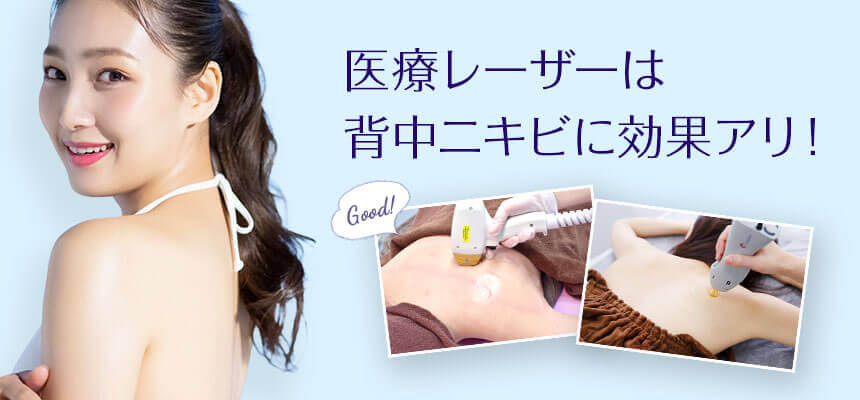 医療レーザーの背中脱毛はニキビにも効果アリ