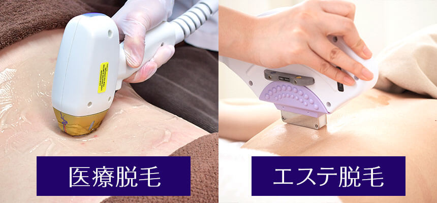 医療脱毛とエステ脱毛のどちらがいいの？医療脱毛のメリットを解説