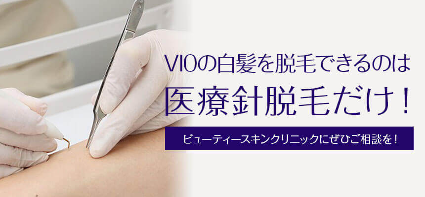 白髪の脱毛ができるのは医療ニードル（針）脱毛だけ
