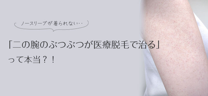 二の腕のぶつぶつの原因と治し方！皮膚科の医療脱毛で治ったって本当？