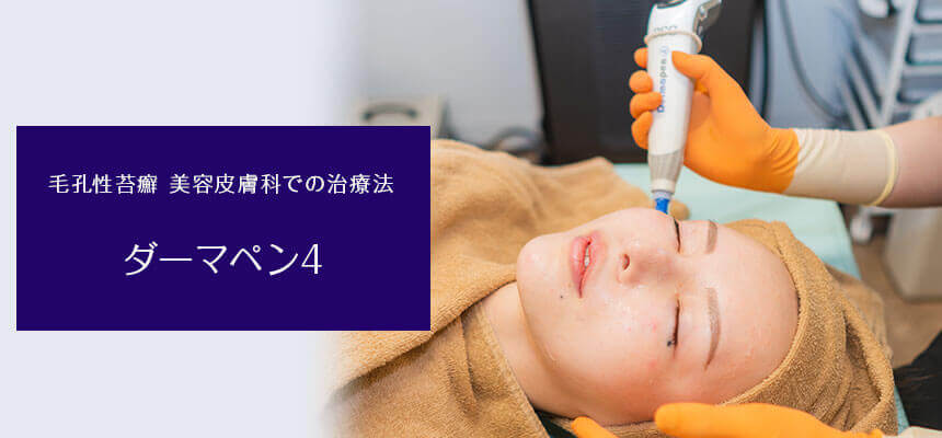 毛孔性苔癬 美容皮膚科での治療法 ダーマペン4