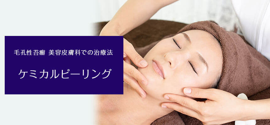 毛孔性苔癬 美容皮膚科での治療法 ケミカルピーリング