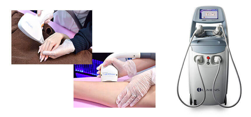 ダイオードレーザによる脱毛について