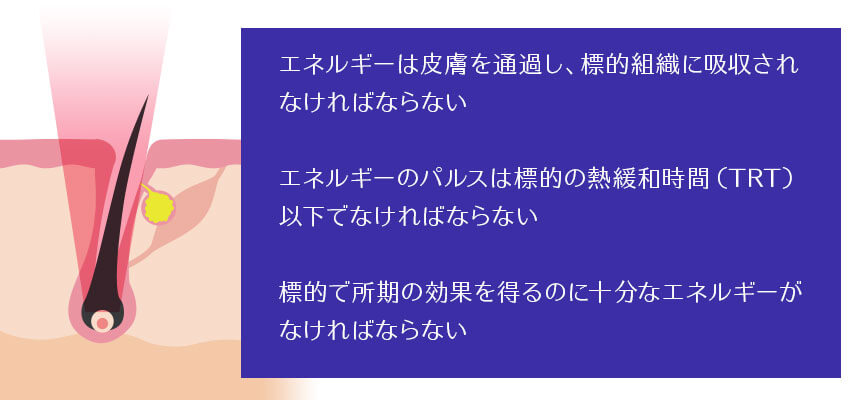 脱毛するためのレーザーの条件