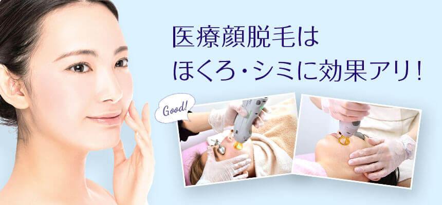 医療顔脱毛はホクロ・シミにも効果アリ ニキビも大丈夫