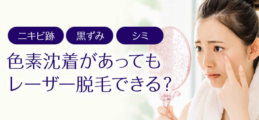 レーザー脱毛は色素沈着があってもできるの？改善されるの？