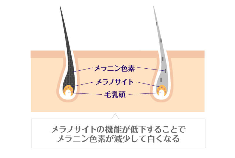 そもそもVIOに白髪が生えるメカニズムとは