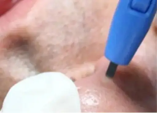 BEAUTY SKIN CLINIC（ビューティースキンクリニック） 新AGNES（アグネス）