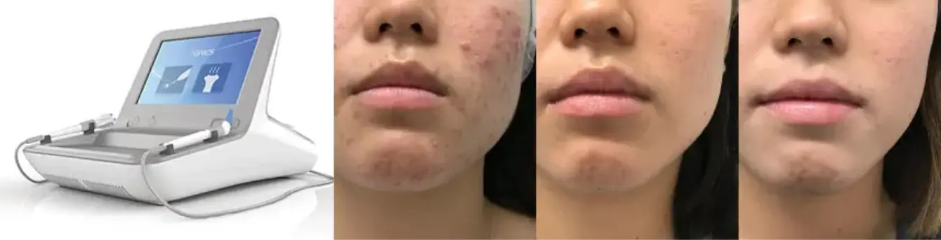 BEAUTY SKIN CLINIC（ビューティースキンクリニック） 新AGNES（アグネス）