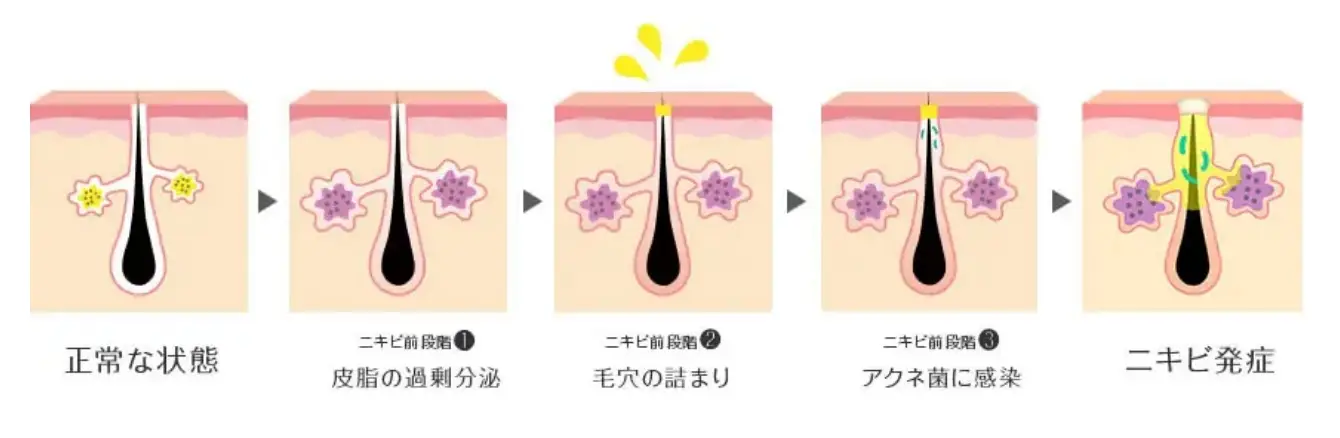 BEAUTY SKIN CLINIC（ビューティースキンクリニック） 新AGNES（アグネス）