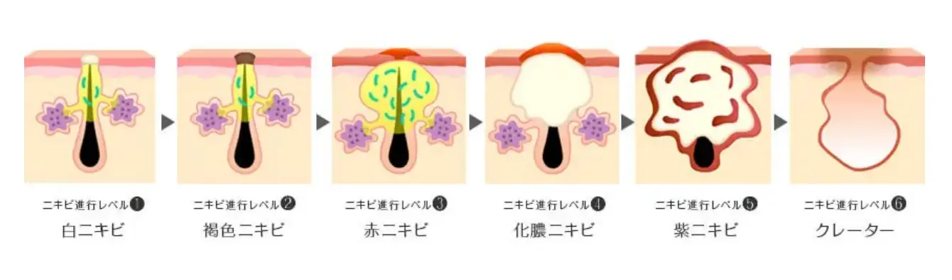 BEAUTY SKIN CLINIC（ビューティースキンクリニック） 新AGNES（アグネス）