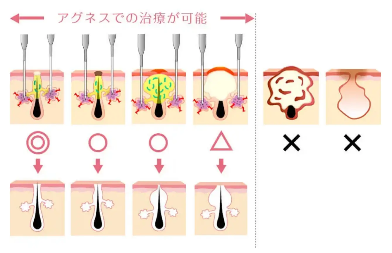 BEAUTY SKIN CLINIC（ビューティースキンクリニック） 新AGNES（アグネス）