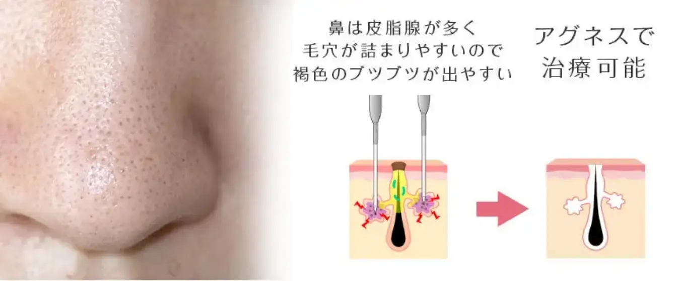 BEAUTY SKIN CLINIC（ビューティースキンクリニック） 新AGNES（アグネス）