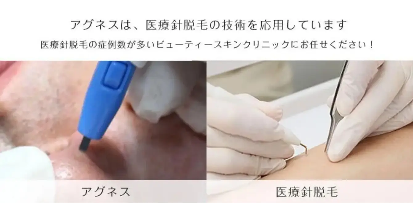 BEAUTY SKIN CLINIC（ビューティースキンクリニック） 新AGNES（アグネス）