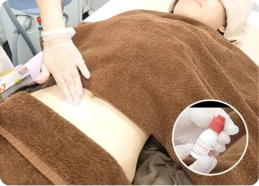 BEAUTY SKIN CLINIC（ビューティースキンクリニック） オールマシンセレクト全身+うなじ 医療脱毛4回完了プラン