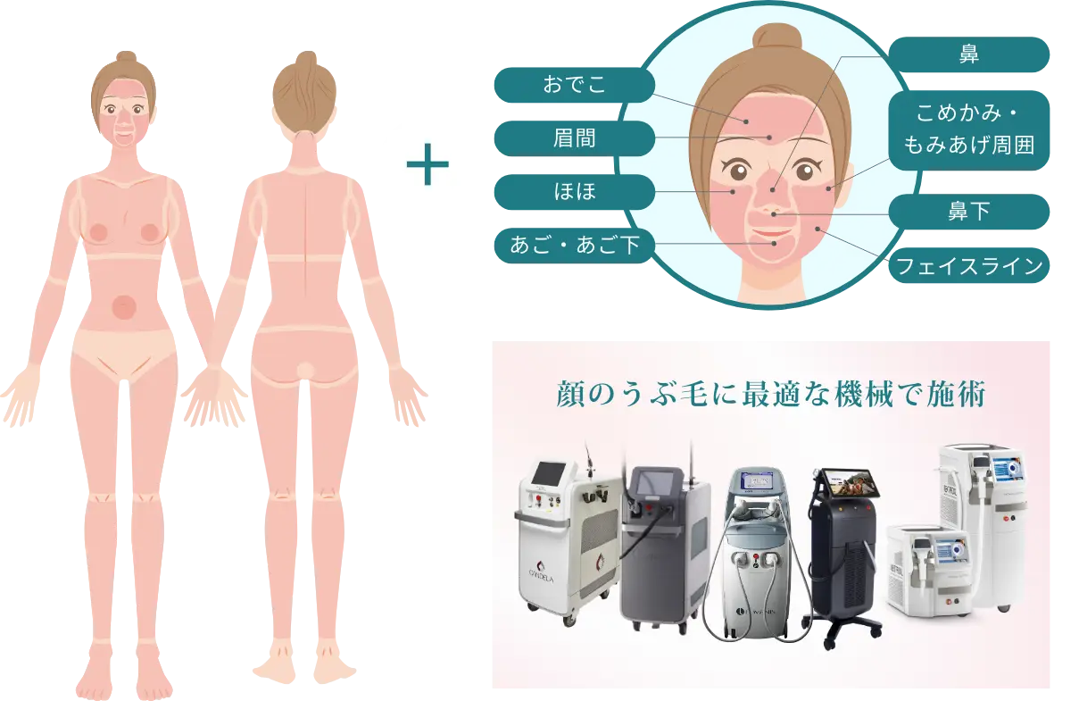 BEAUTY SKIN CLINIC（ビューティースキンクリニック） オールマシンセレクト全身+うなじ 医療脱毛4回完了プラン