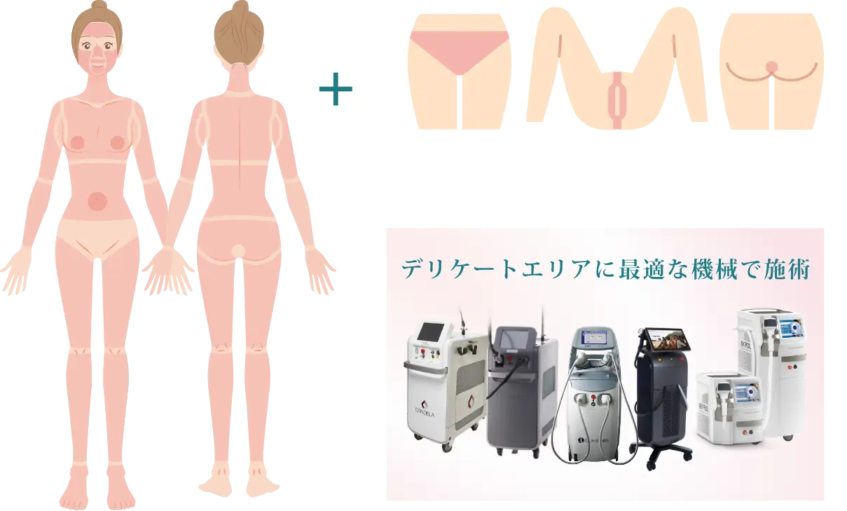 BEAUTY SKIN CLINIC（ビューティースキンクリニック） オールマシンセレクト全身+うなじ 医療脱毛4回完了プラン