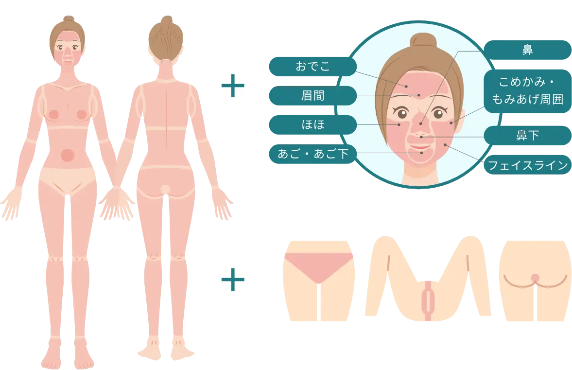 BEAUTY SKIN CLINIC（ビューティースキンクリニック） オールマシンセレクト全身+うなじ 医療脱毛4回完了プラン