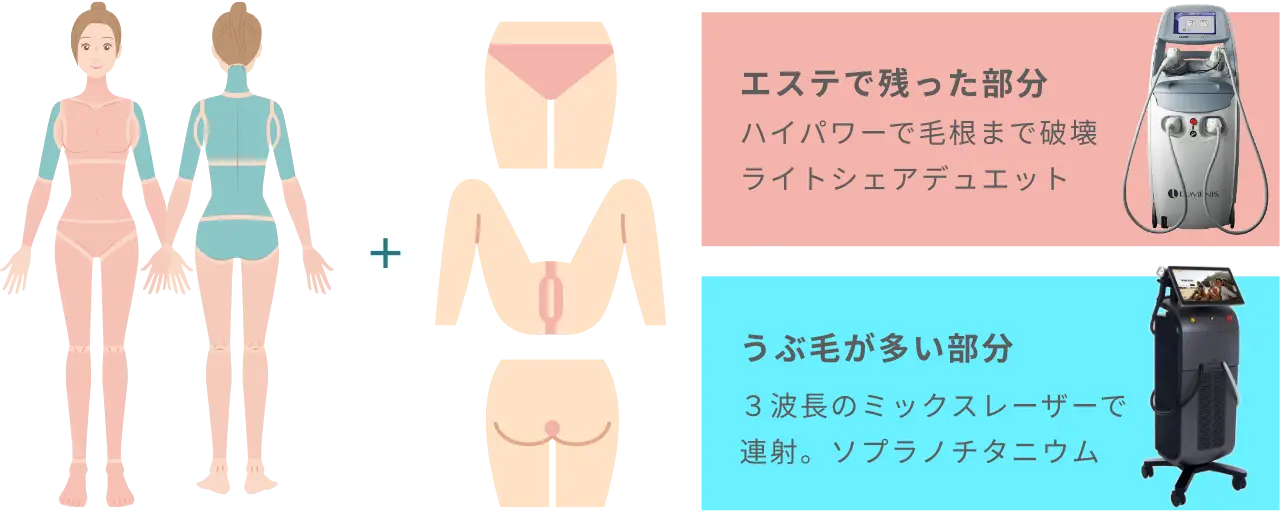 BEAUTY SKIN CLINIC（ビューティースキンクリニック） オールマシンセレクト全身+うなじ 医療脱毛4回完了プラン