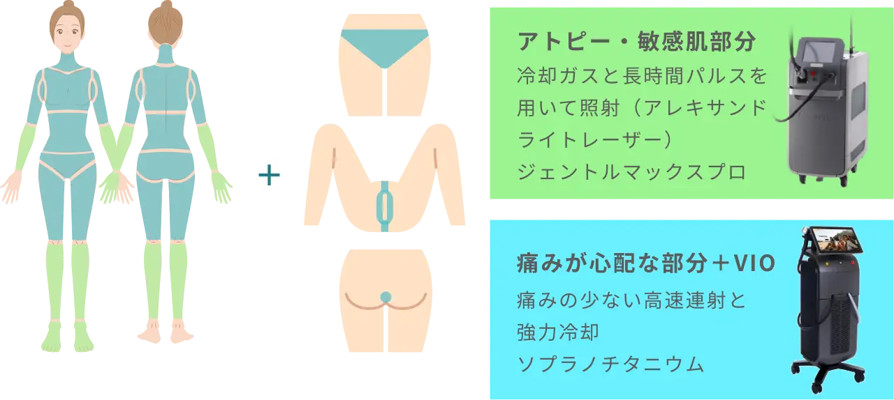 BEAUTY SKIN CLINIC（ビューティースキンクリニック） オールマシンセレクト全身+うなじ 医療脱毛4回完了プラン