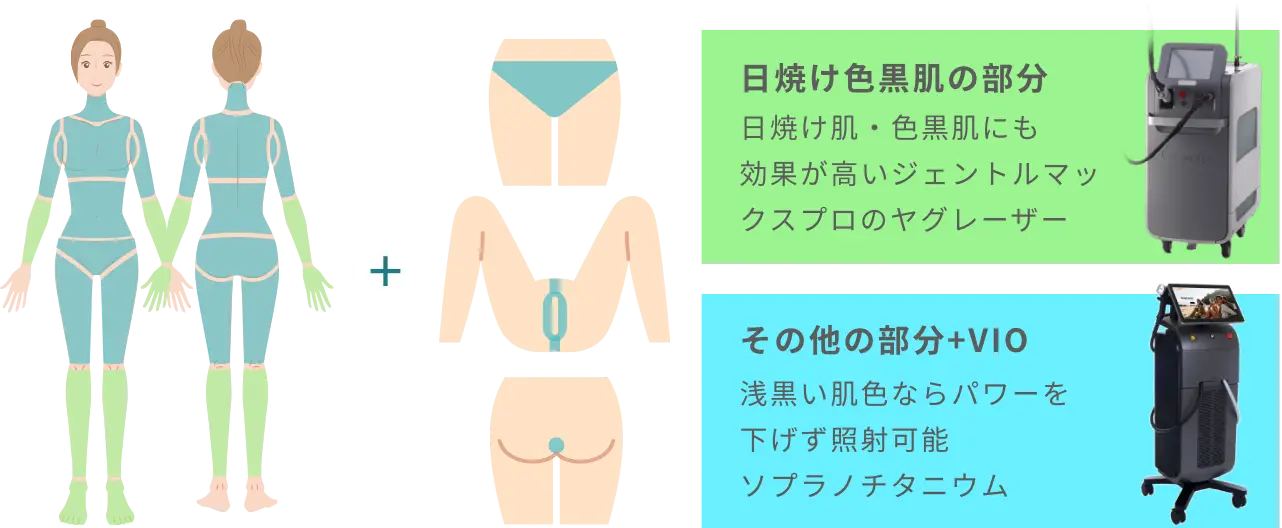 BEAUTY SKIN CLINIC（ビューティースキンクリニック） オールマシンセレクト全身+うなじ 医療脱毛4回完了プラン