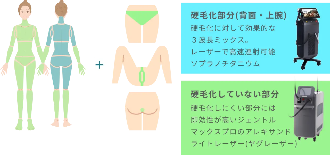 BEAUTY SKIN CLINIC（ビューティースキンクリニック） オールマシンセレクト全身+うなじ 医療脱毛4回完了プラン