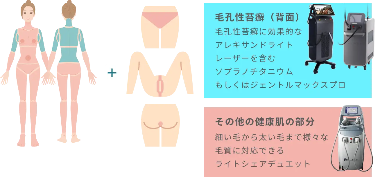 BEAUTY SKIN CLINIC（ビューティースキンクリニック） オールマシンセレクト全身+うなじ 医療脱毛4回完了プラン