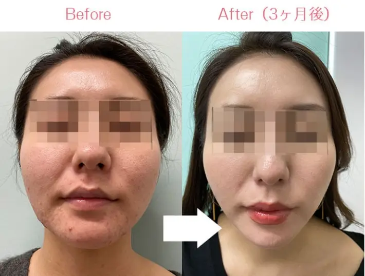 BEAUTY SKIN CLINIC(ビューティースキンクリニック) 治療例