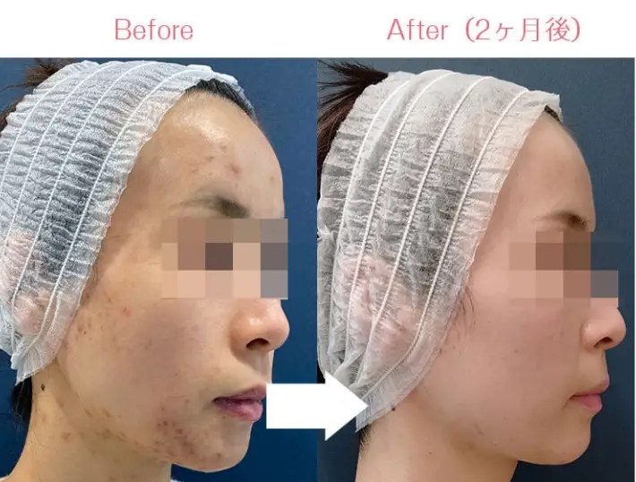 BEAUTY SKIN CLINIC(ビューティースキンクリニック) 治療例