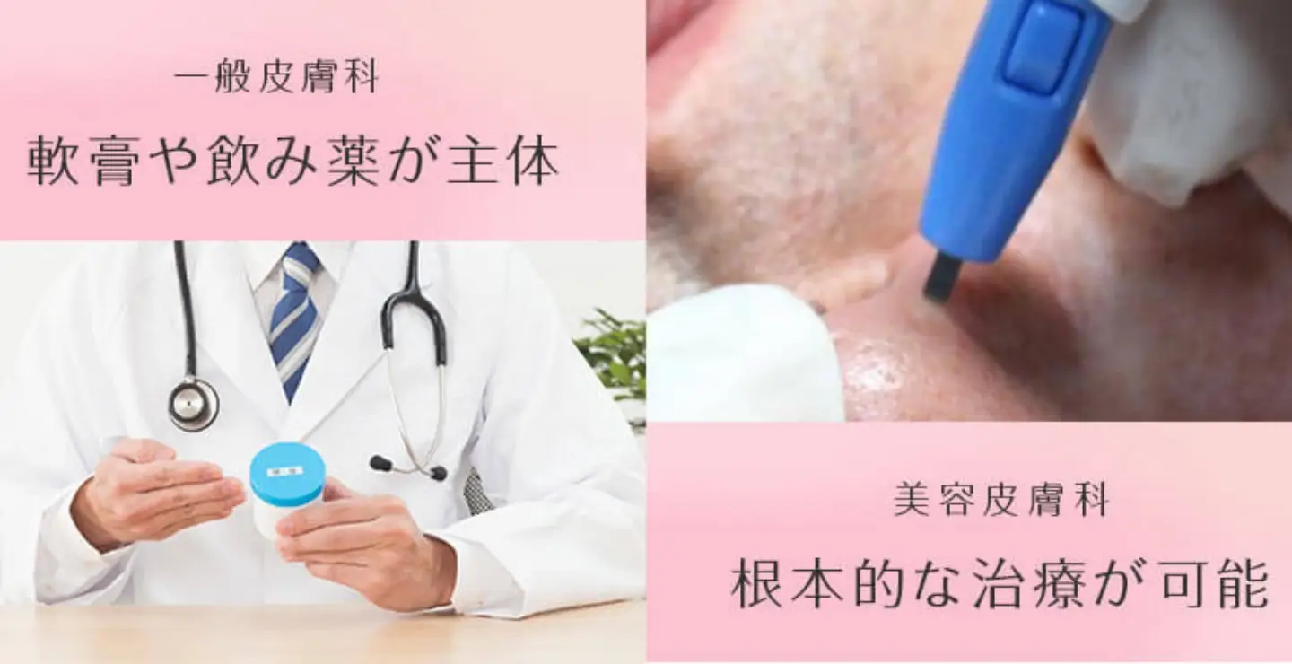 BEAUTY SKIN CLINIC（ビューティースキンクリニック） 一般皮膚科との違い