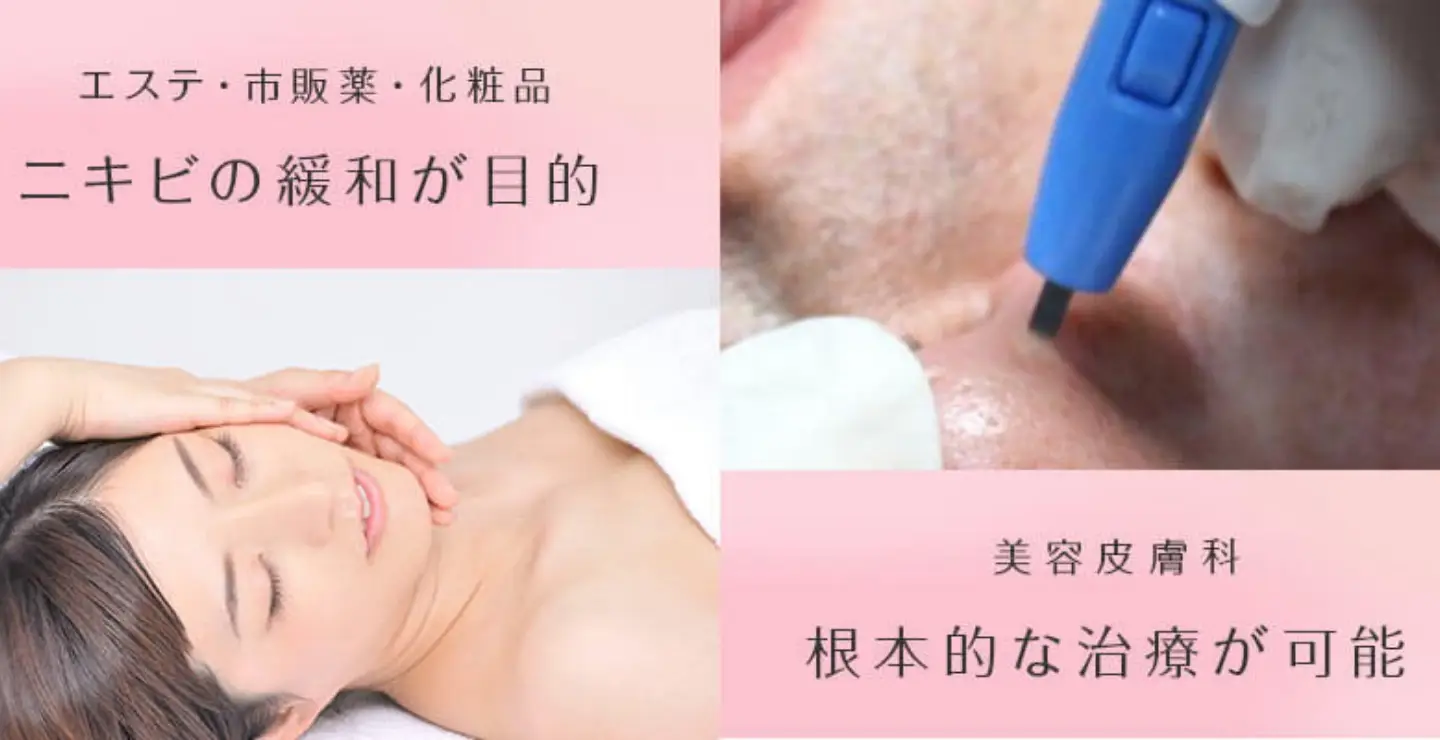 BEAUTY SKIN CLINIC（ビューティースキンクリニック） エステ・市販薬・化粧品との違い