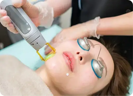 BEAUTY SKIN CLINIC（ビューティースキンクリニック） 全顔医療脱毛セット