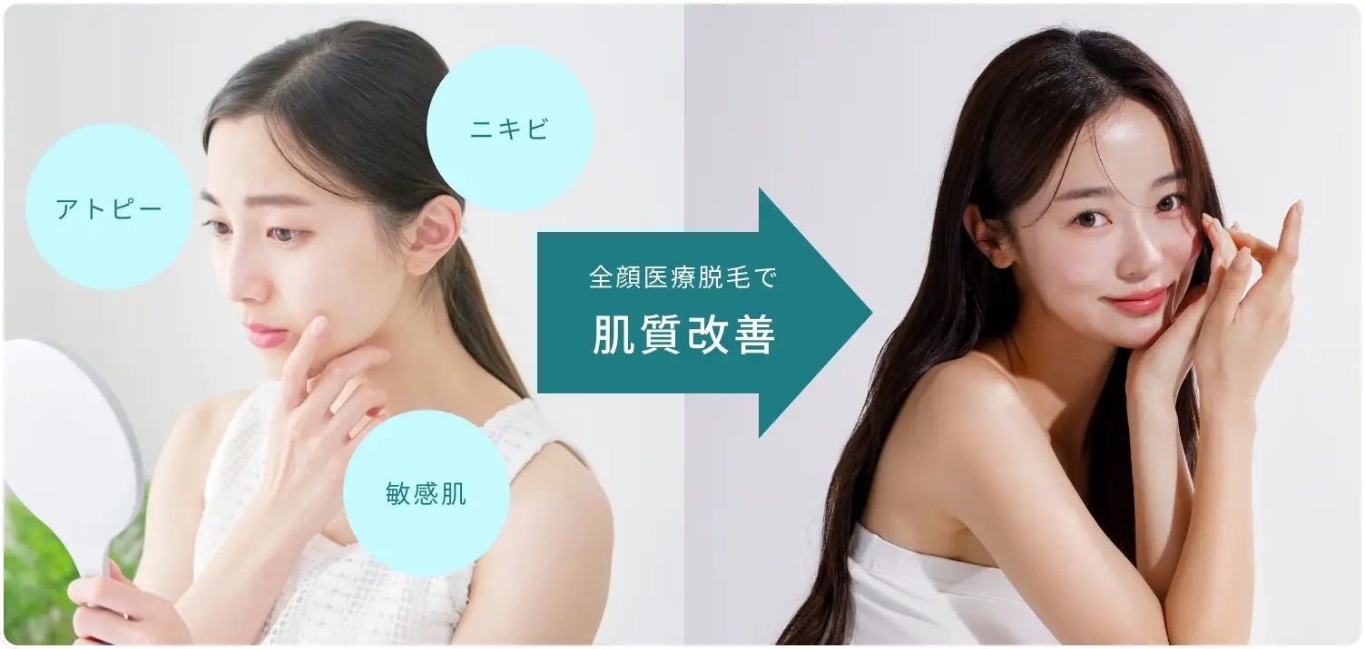 BEAUTY SKIN CLINIC（ビューティースキンクリニック） 全顔医療脱毛セット