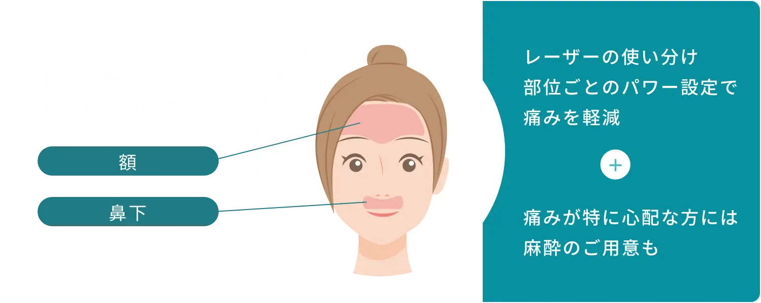 BEAUTY SKIN CLINIC（ビューティースキンクリニック） 全顔医療脱毛セット