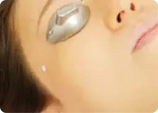 BEAUTY SKIN CLINIC（ビューティースキンクリニック） 全顔医療脱毛セット