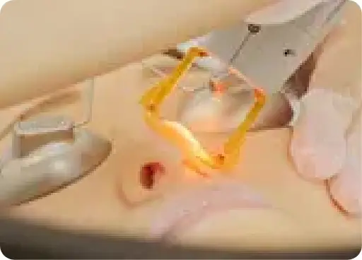 BEAUTY SKIN CLINIC（ビューティースキンクリニック） 全顔医療脱毛セット