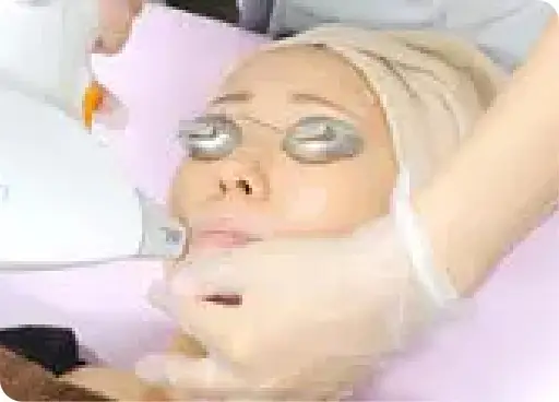 BEAUTY SKIN CLINIC（ビューティースキンクリニック） 全顔医療脱毛セット