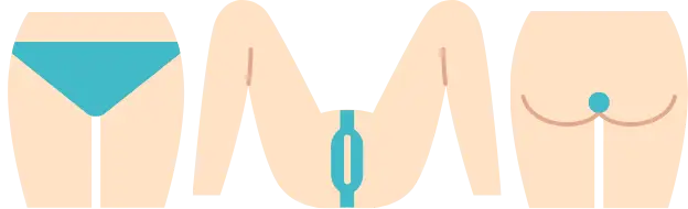 BEAUTY SKIN CLINIC（ビューティースキンクリニック） 最新型ジェントルマックスプロプラス