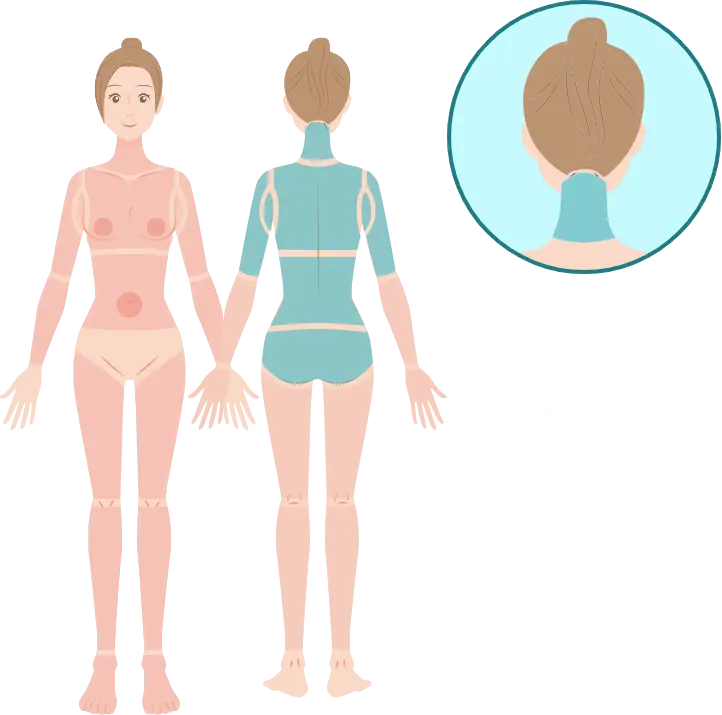 BEAUTY SKIN CLINIC（ビューティースキンクリニック） 最新型ジェントルマックスプロプラス