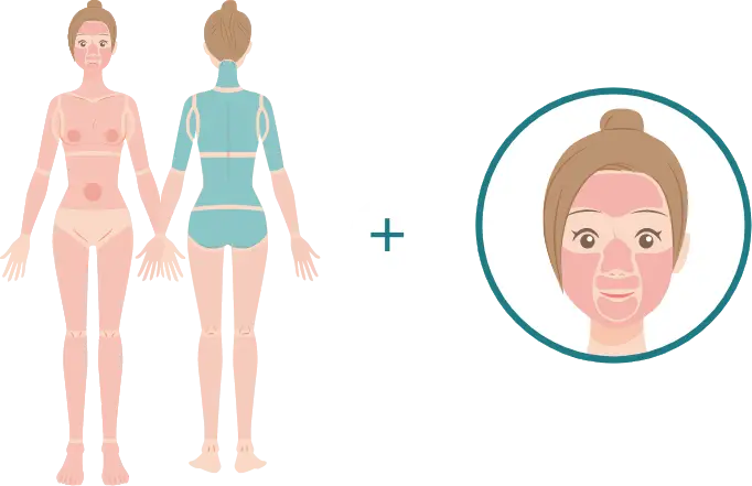 BEAUTY SKIN CLINIC（ビューティースキンクリニック） 最新型ジェントルマックスプロプラス